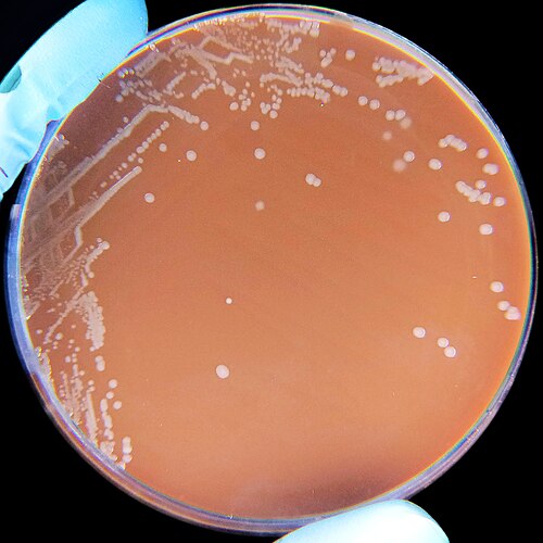 Bacillus influenzae